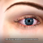 <b>TearScience<sup>TM</sup> LipiFlow<sup>TM</sup>  </b> System patient animation